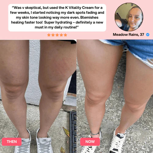 SheVitality™ Cellulite Relief Kit